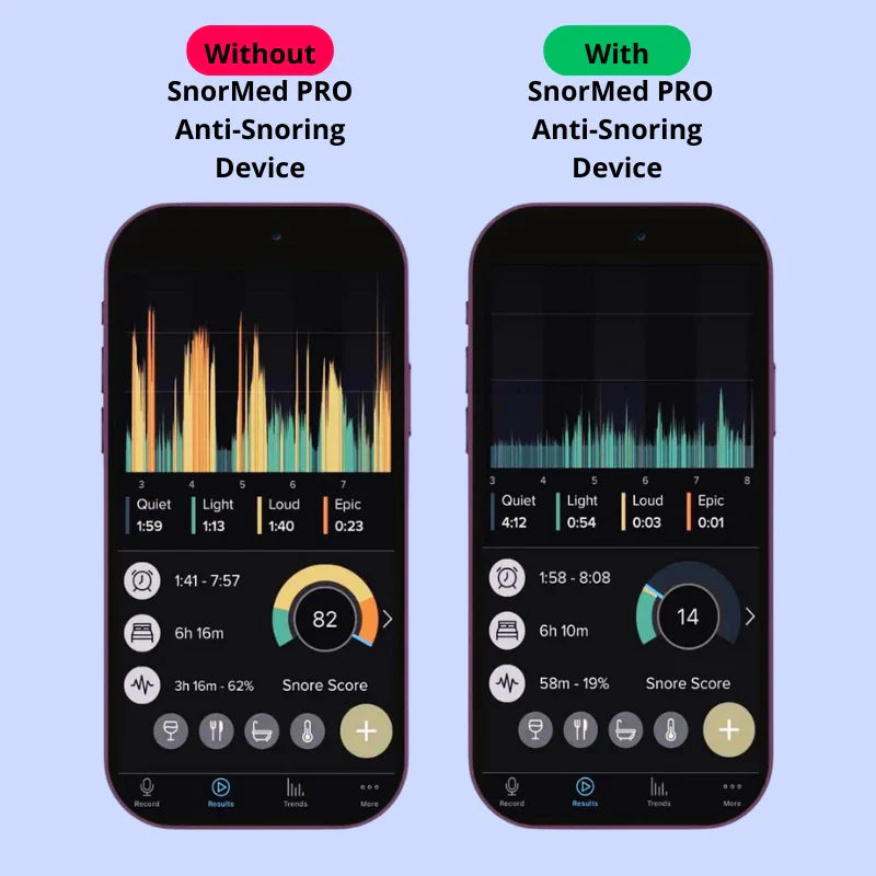 SnorMed™ PRO Anti-Snoring Device